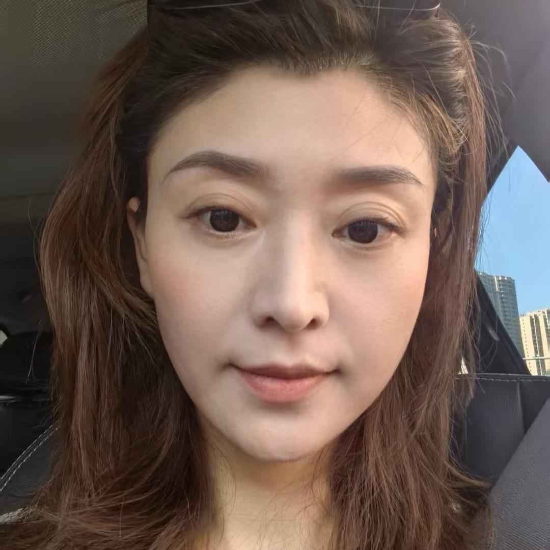 徐美丽