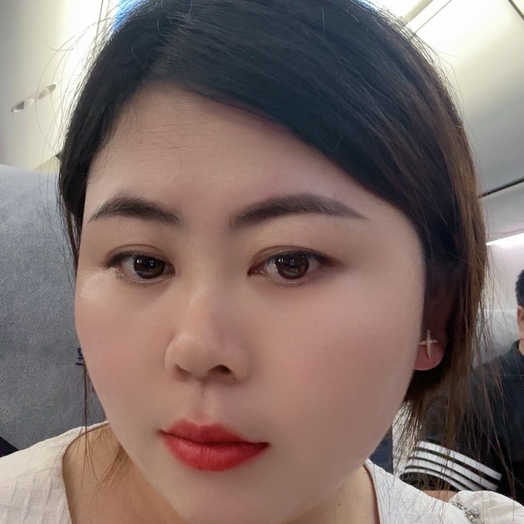 赵娟