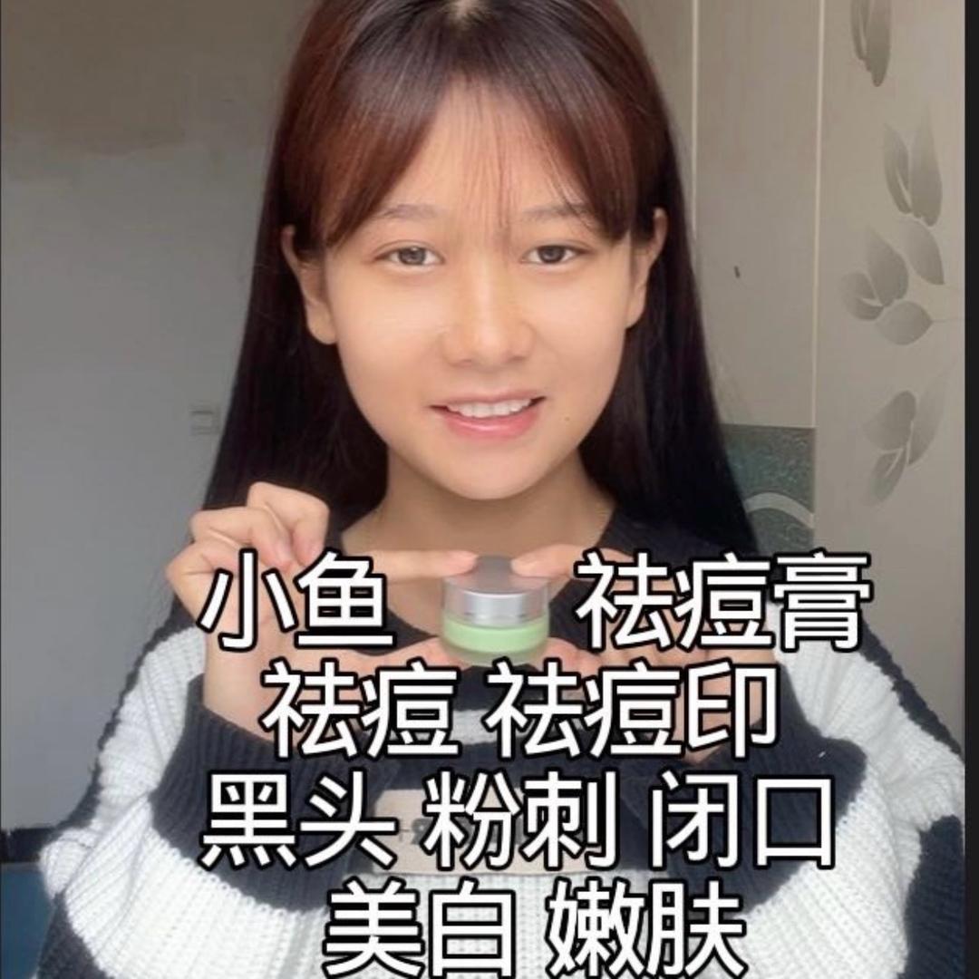 鱼表妹🐠朋友圈 （祛痘膏）