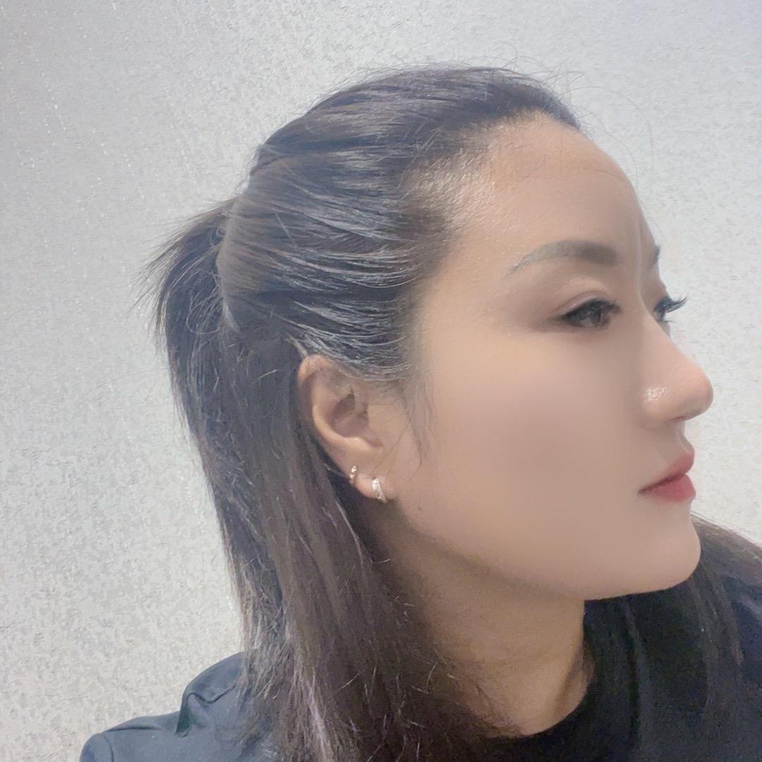珍妮
