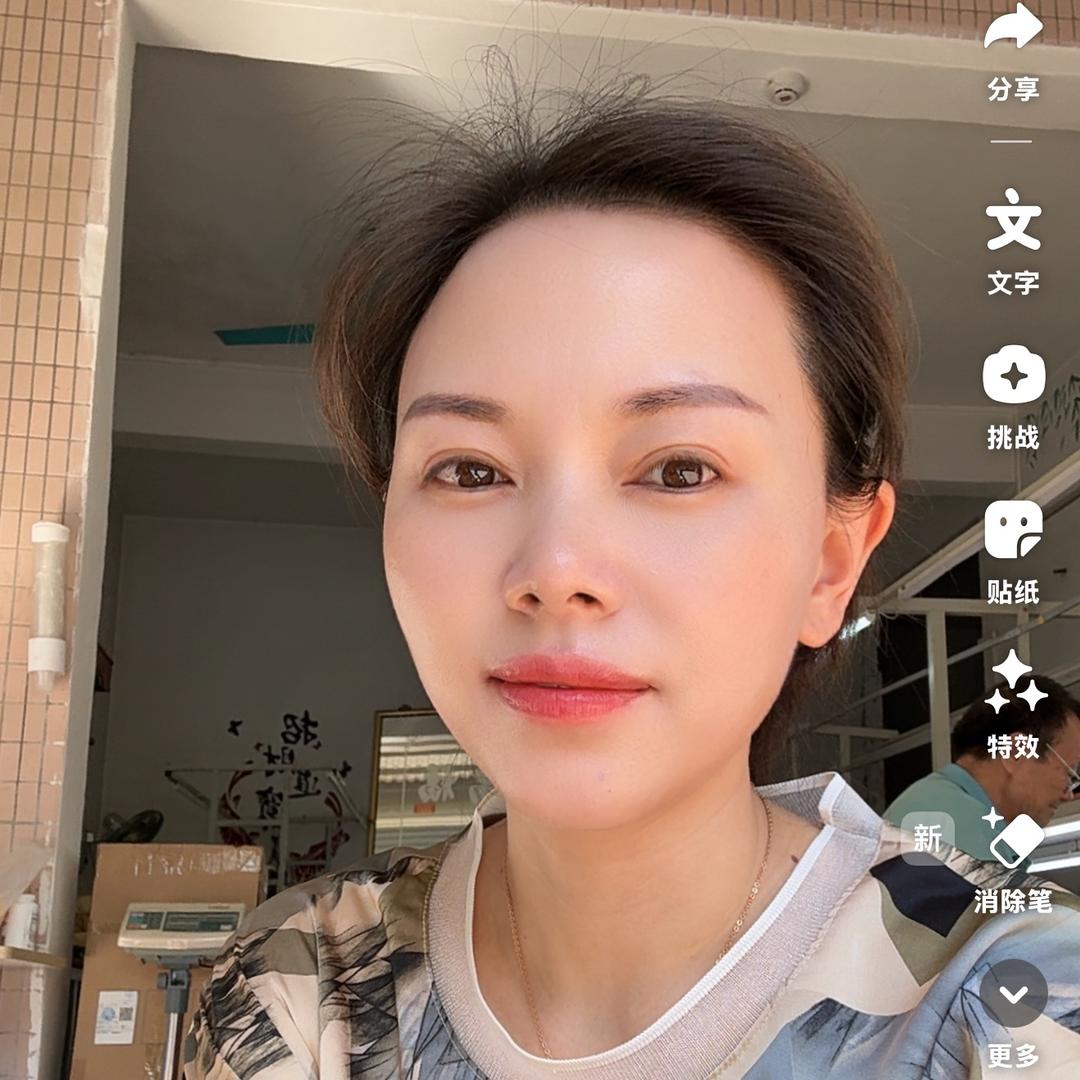 阿红