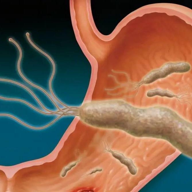 肠治久安胃雨绸缪