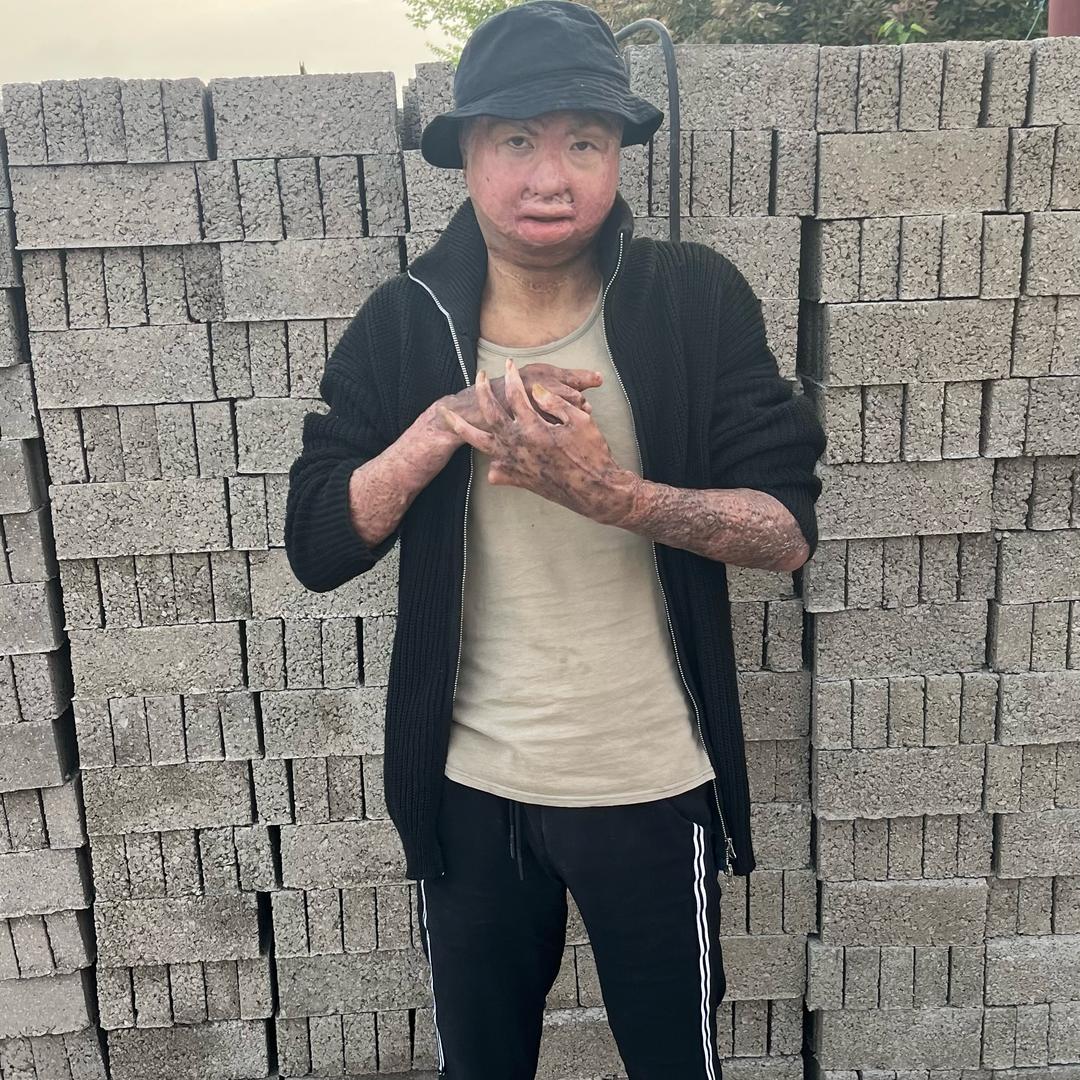 励志阿明