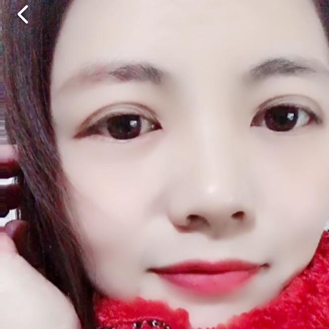 阿惠