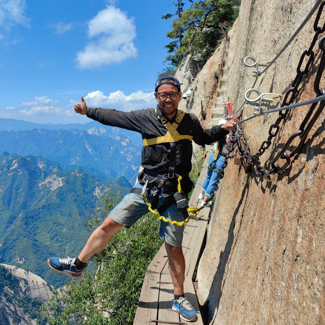 腿里放着钢板的肌肉虎
