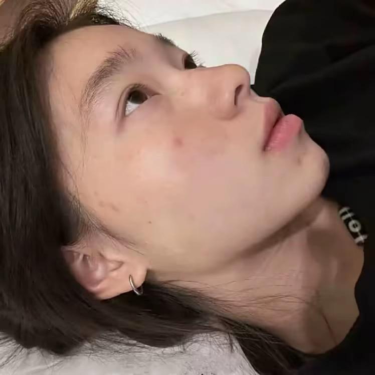 小番茄