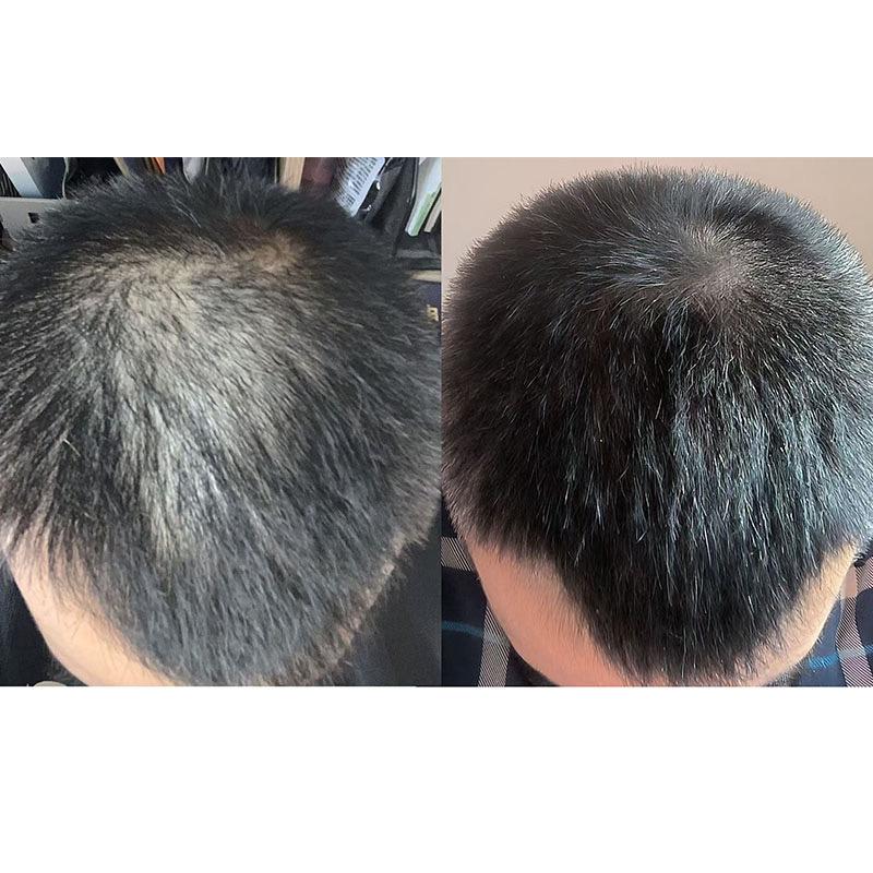 大峰聊养发(1对1指导）