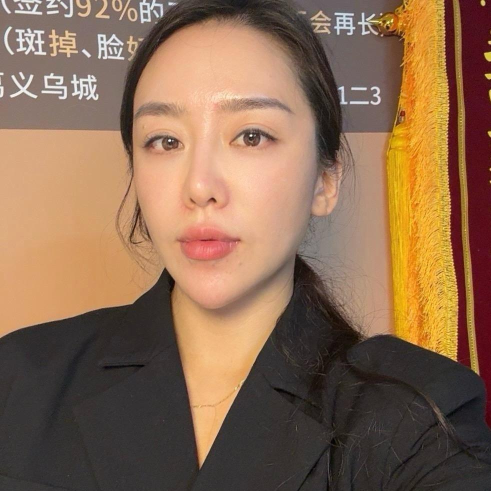 长葛 白老师皮肤管理2