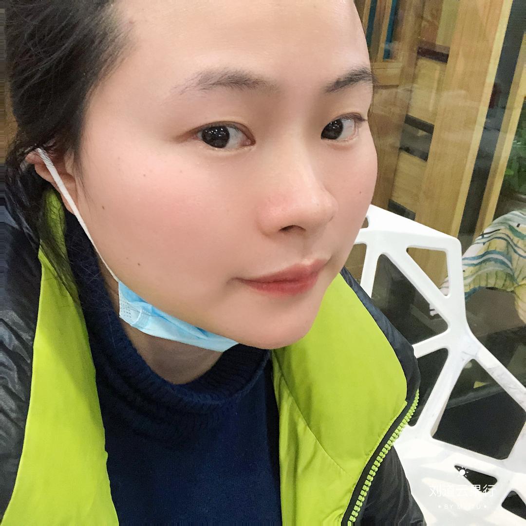 刘皮癣