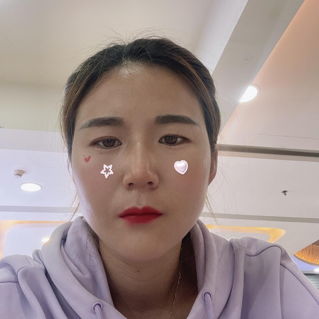慧宝