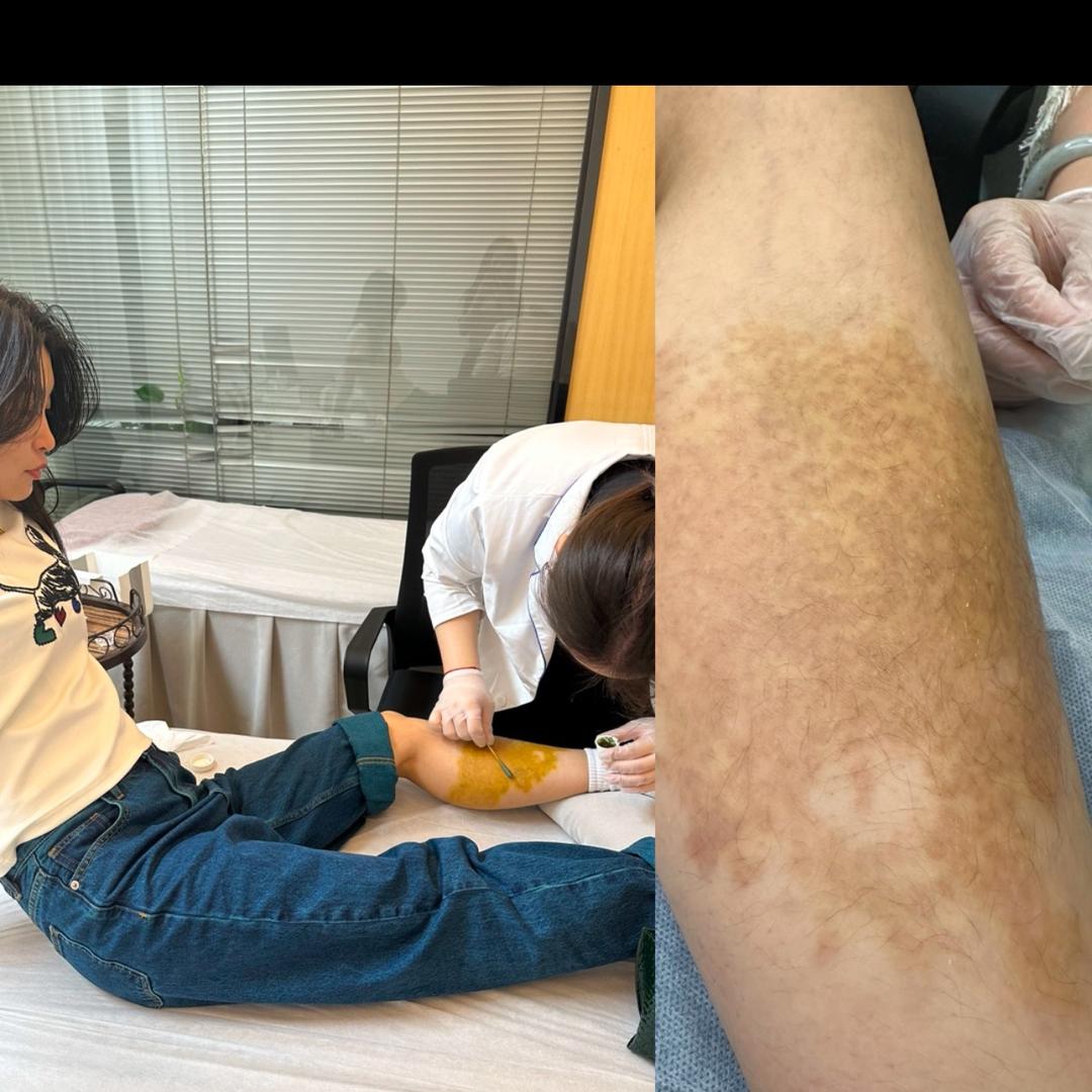 橘子
