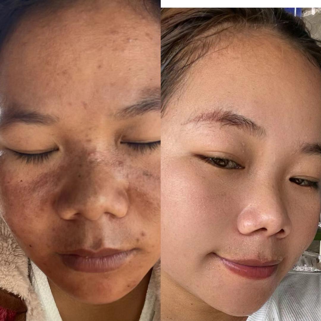 小恩妈妈）产后恢复中已减25斤