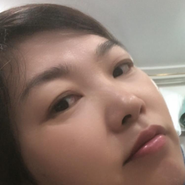 缘