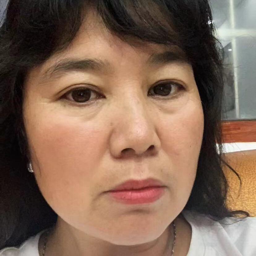 大花（笑口常开）