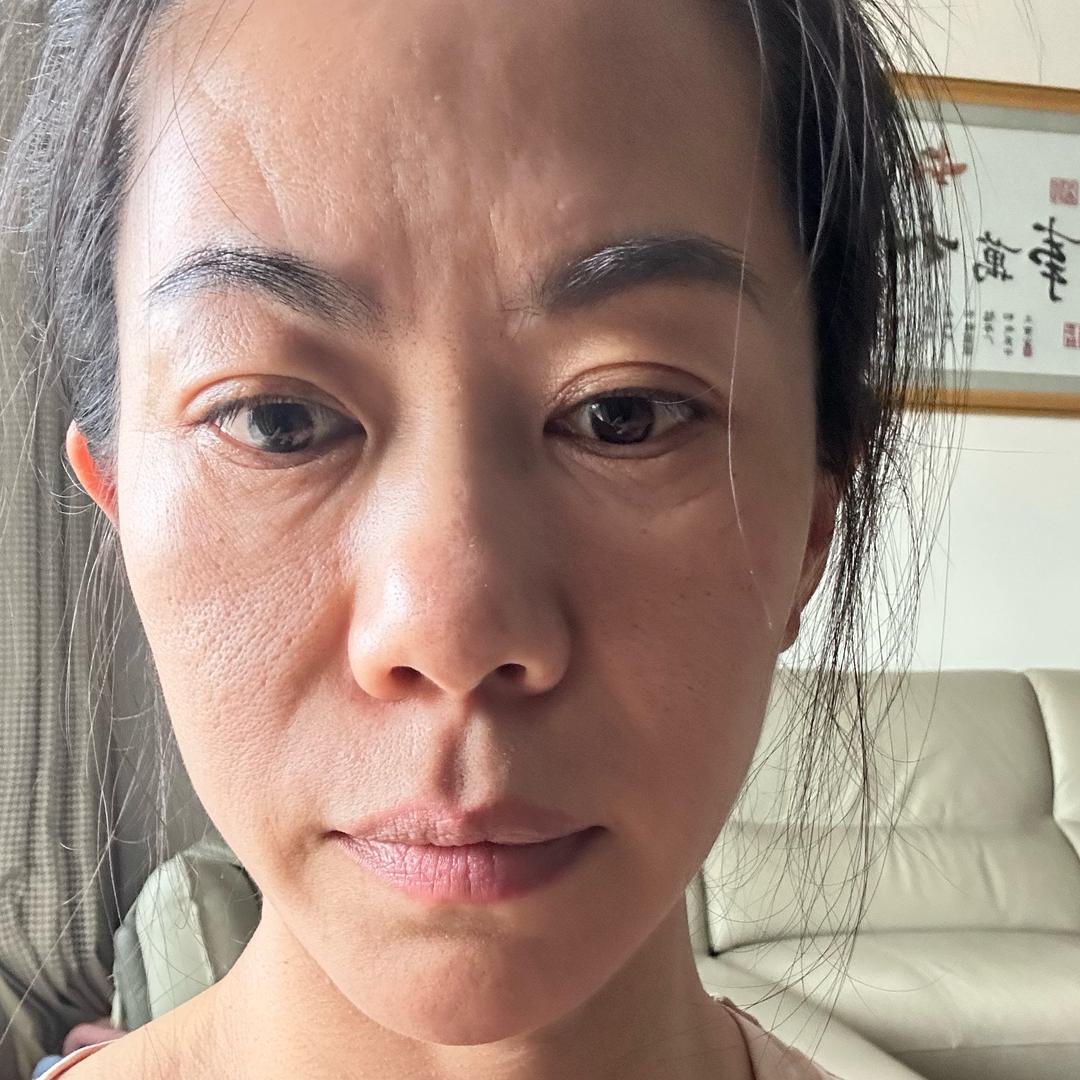 乐妈39岁要改脸😀