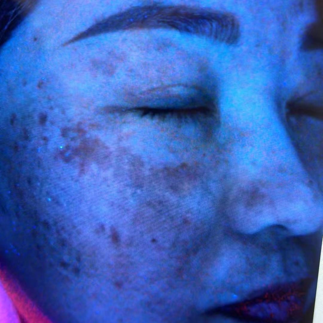 龙湖佳人美容专搞二手斑