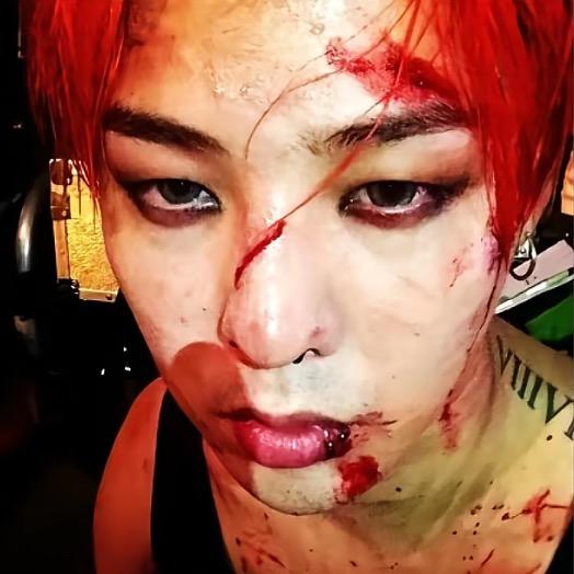 서울병 이 부분✈️