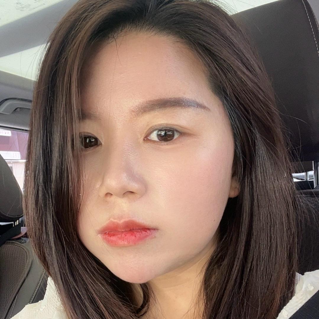 美颜坊疤痕 问题肌管理