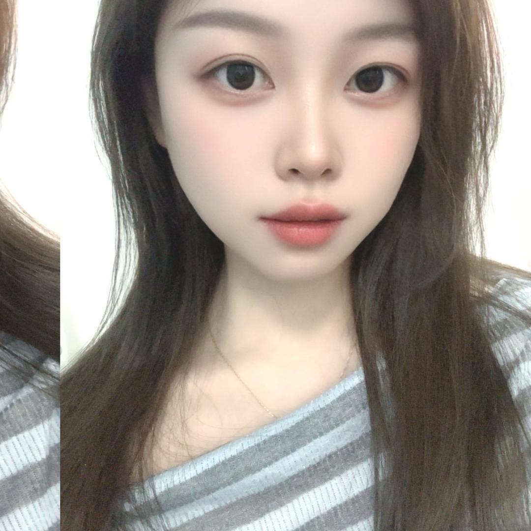 胡子祛除（六安万达店）