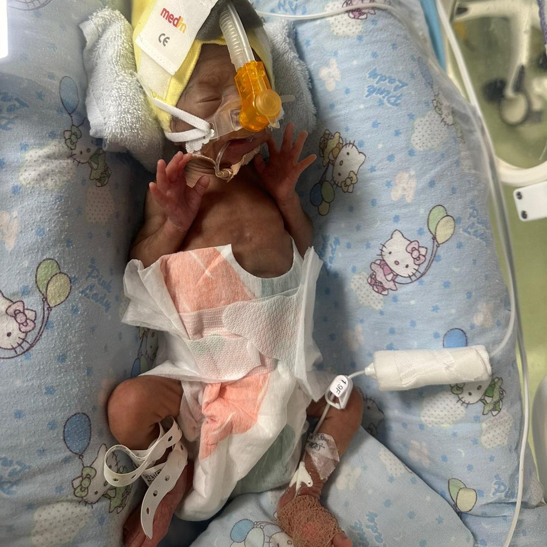 28周早产儿然然