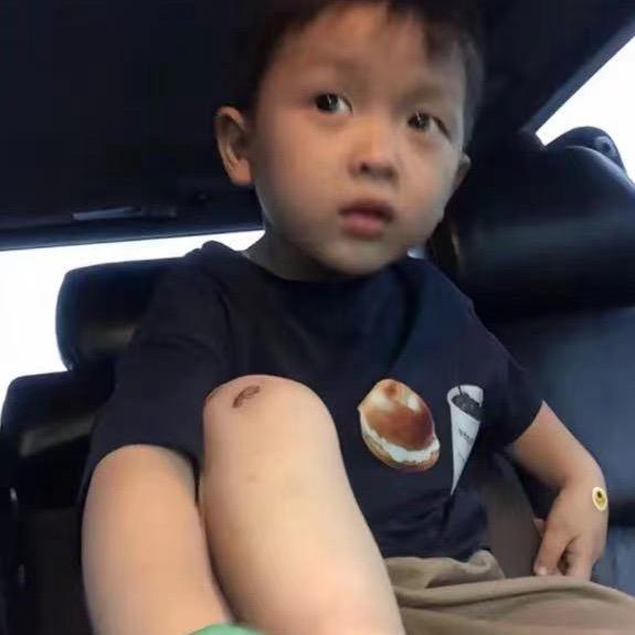 阿▪️⚜️