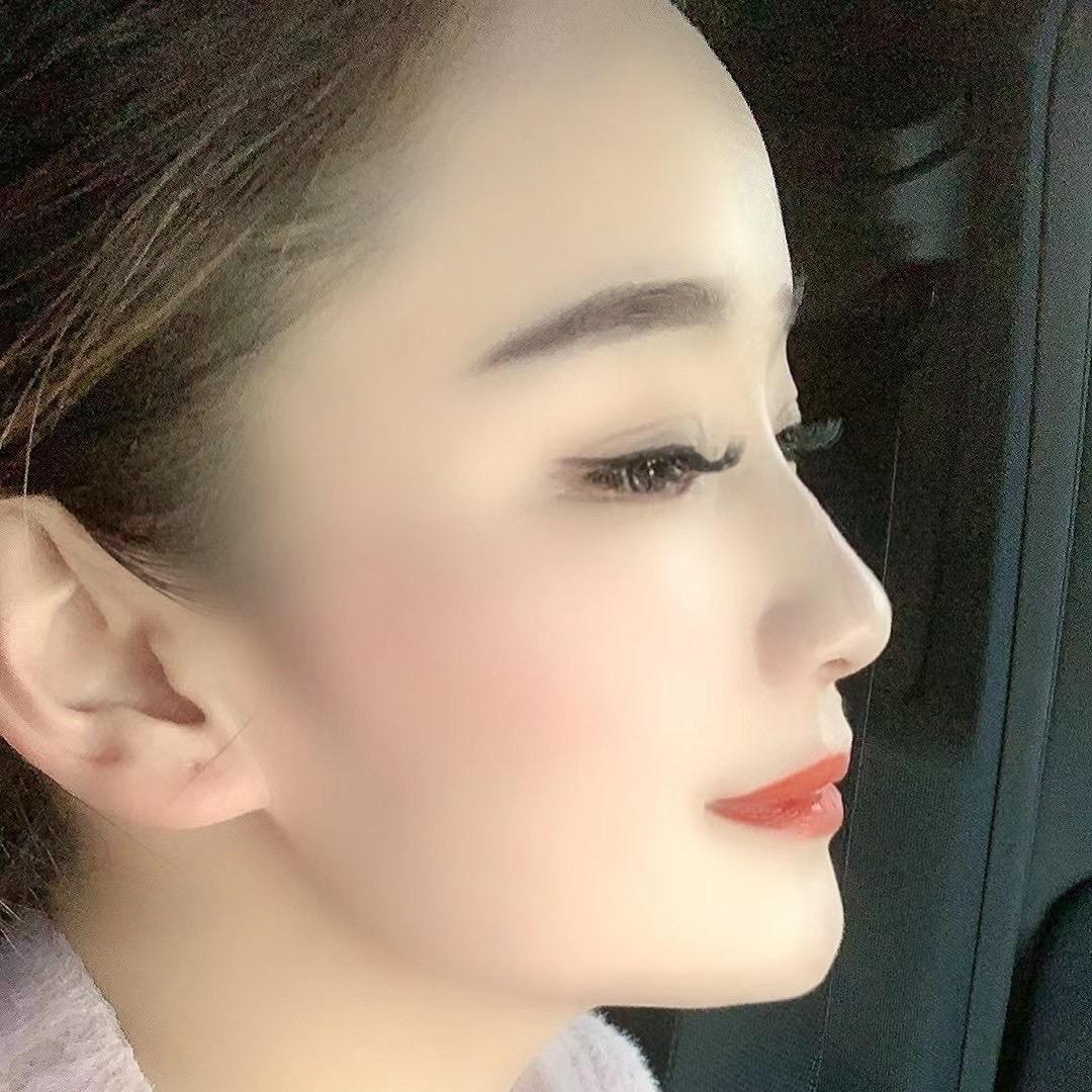 慧慧吖～