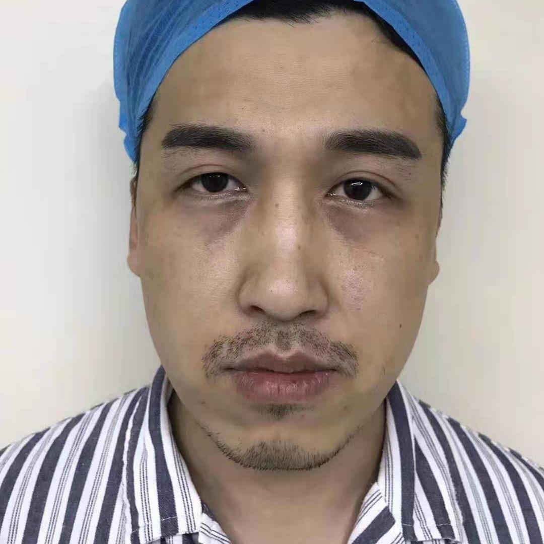 第一深情余院长
