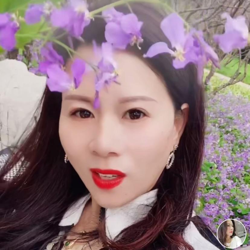 刘大美人（髌骨骨折康复中）