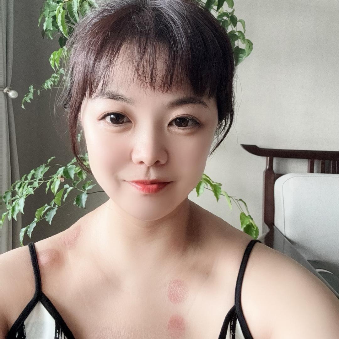 308紫外线光疗仪中透