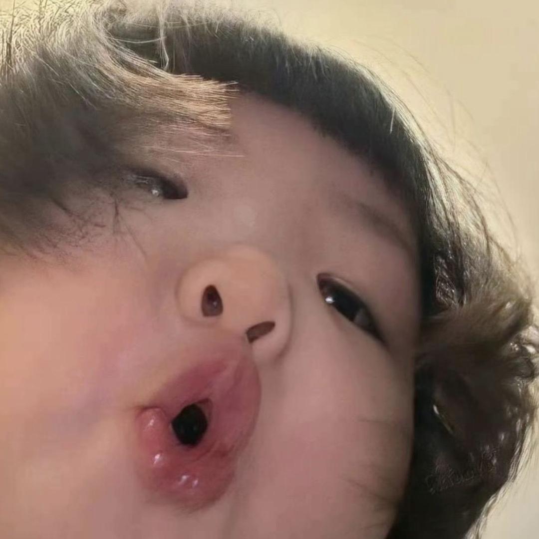 炸弹