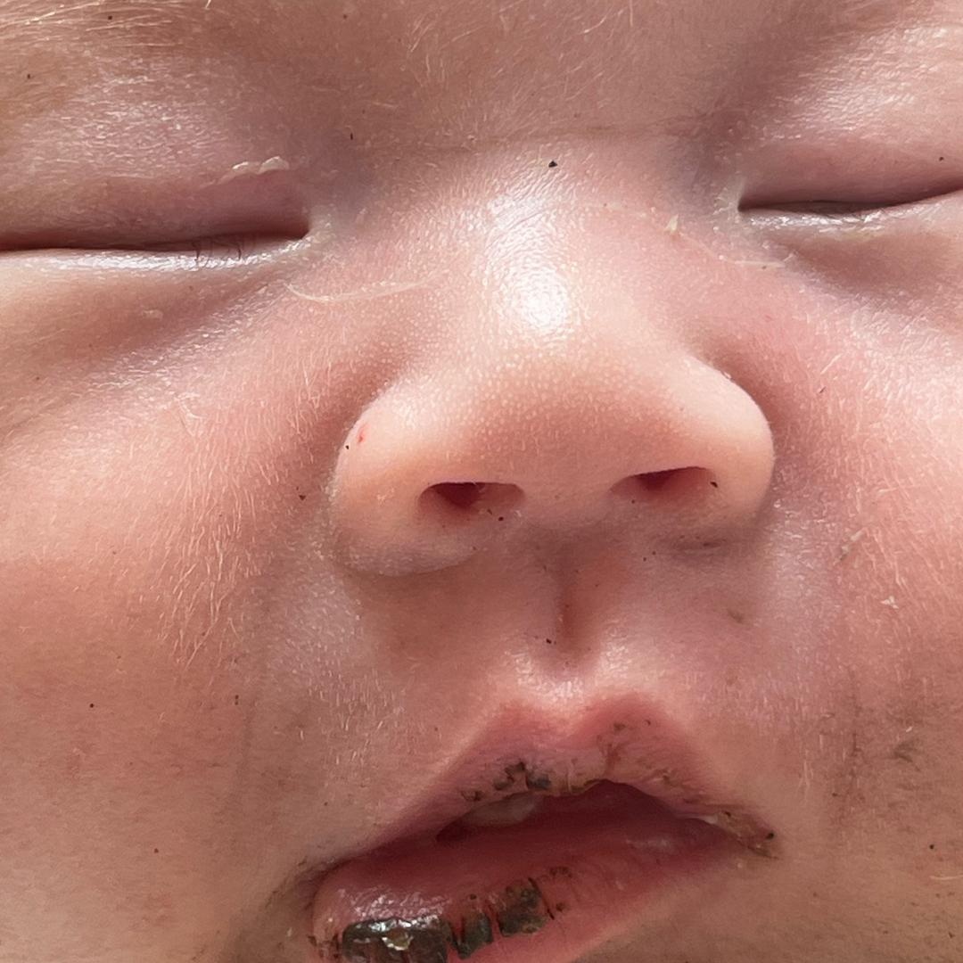 垚垚（蝴蝶宝贝）