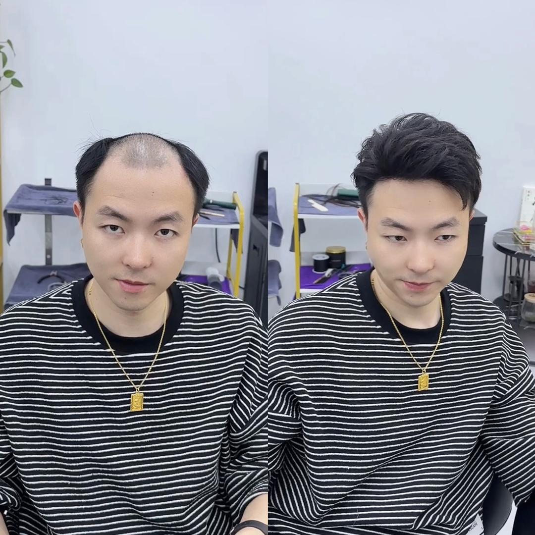 安吉艾伦假发定制