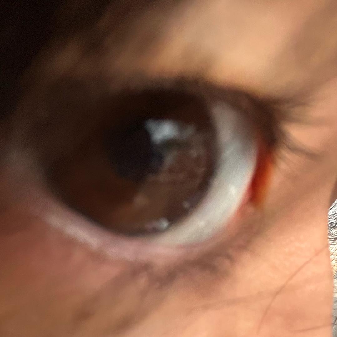 小黑