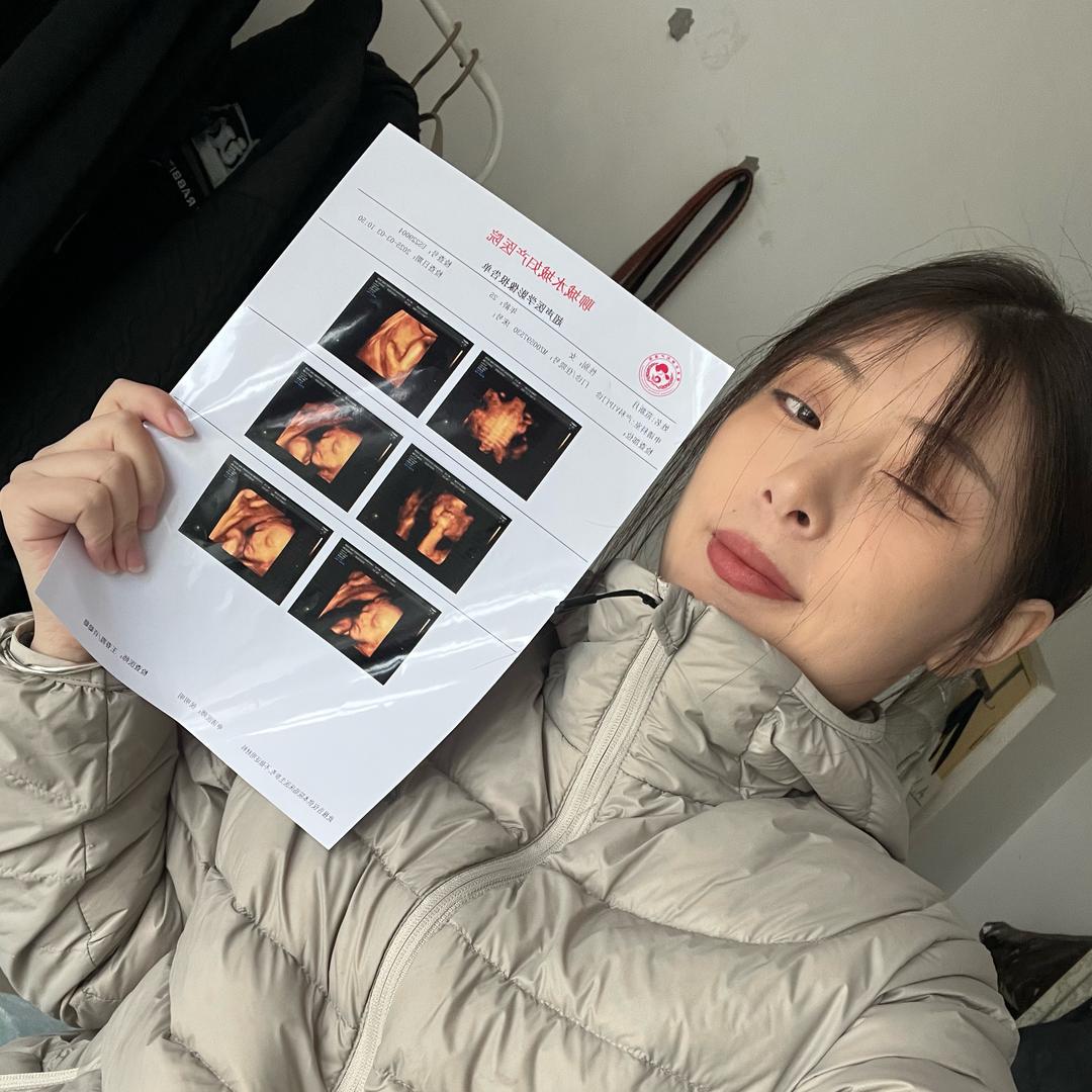 范范.二胎孕中期