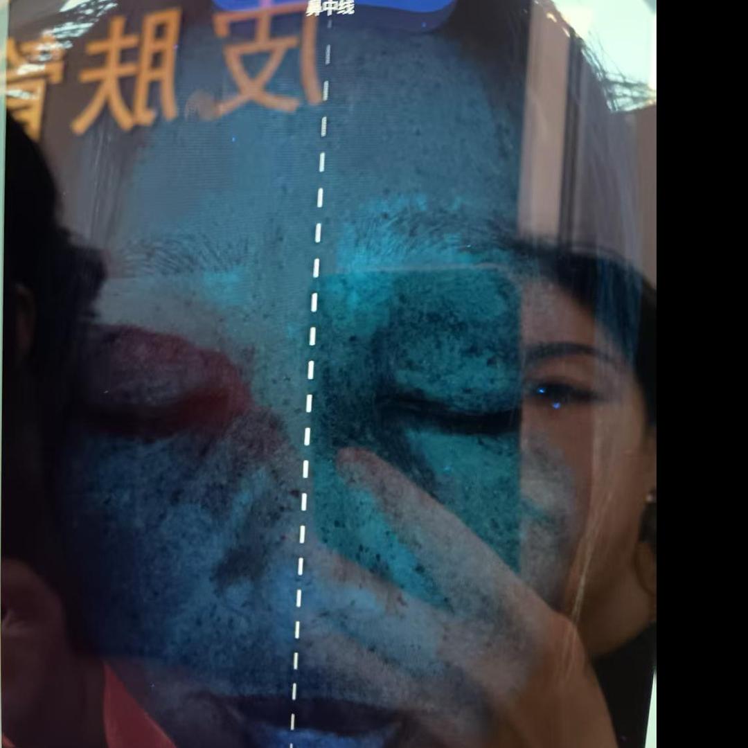 专业拿斑
