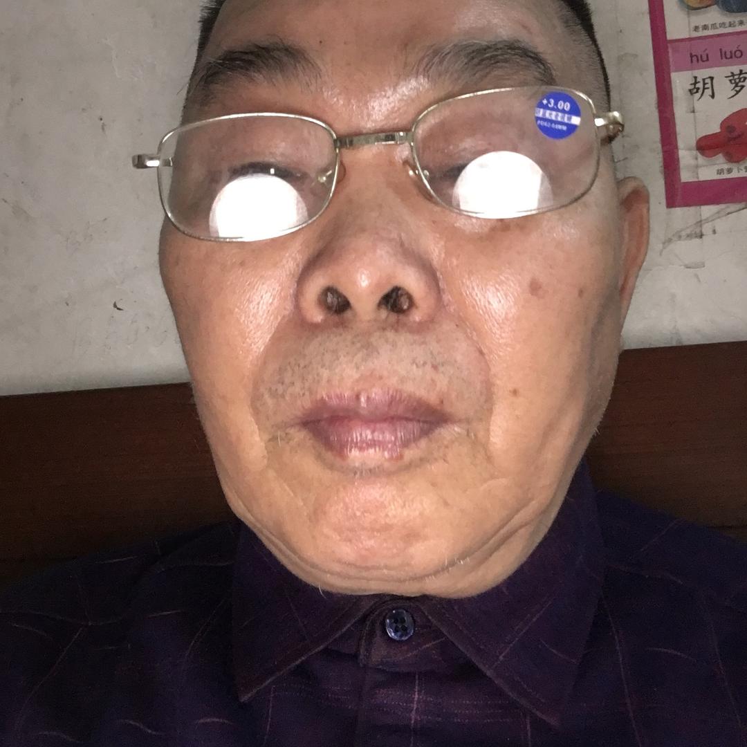 陈祝方好久不见小美