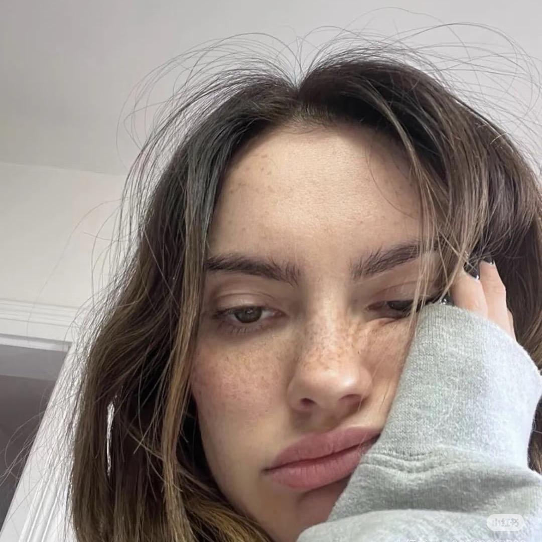 - L