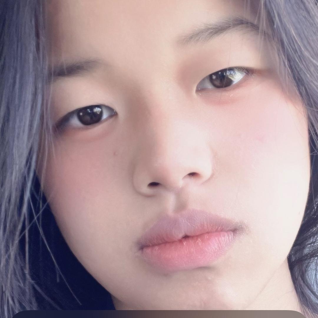 跑不快的大长腿🎉🎉🎉