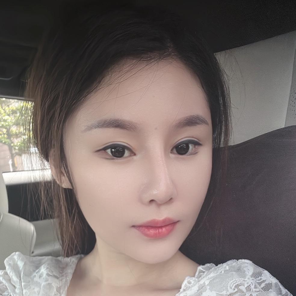杨飞