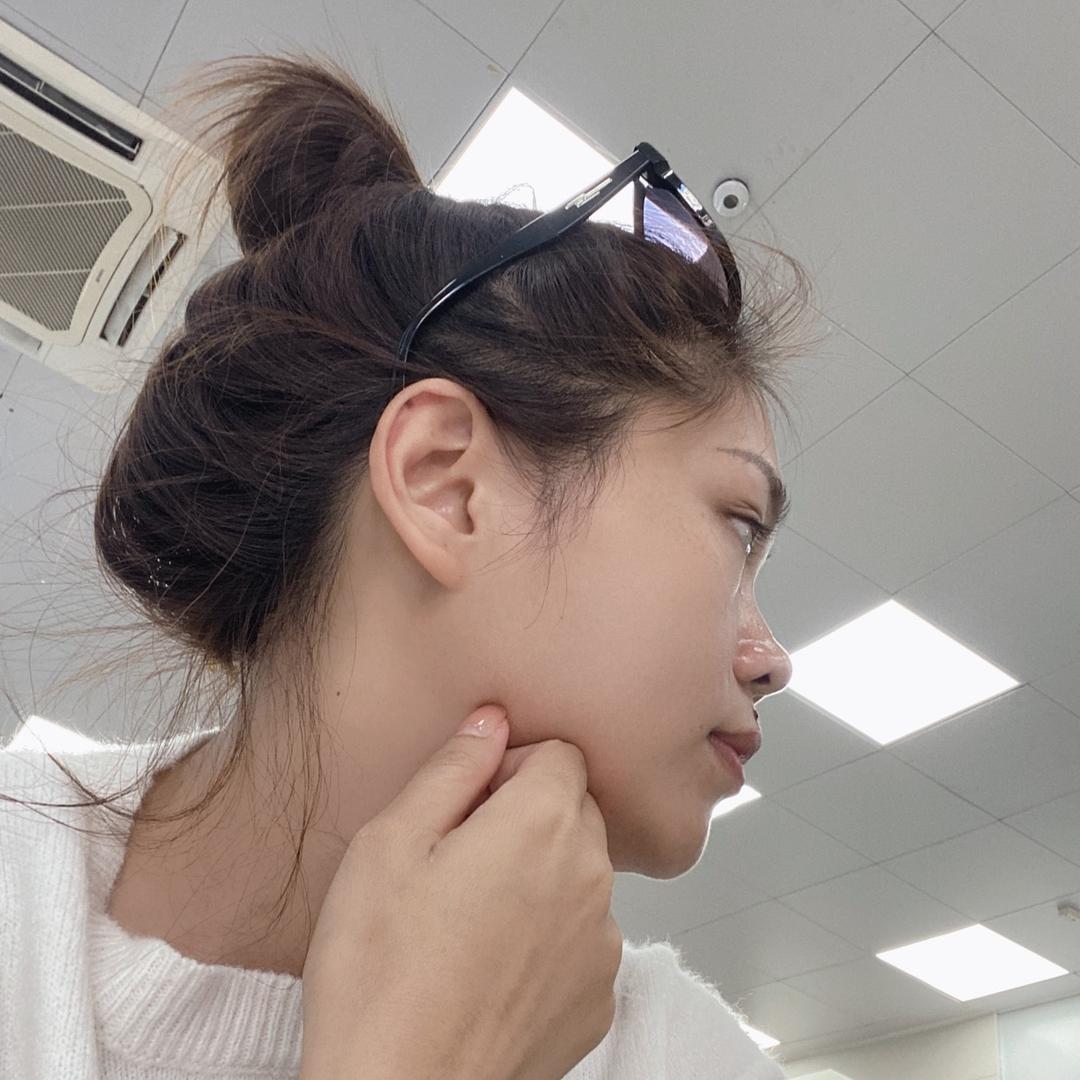 Ting婷