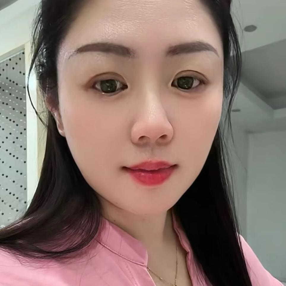 林琳