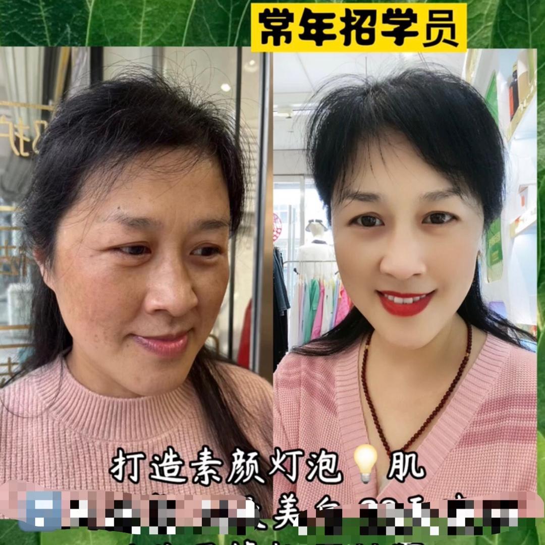 宿州大润发点斑点痣缘姐