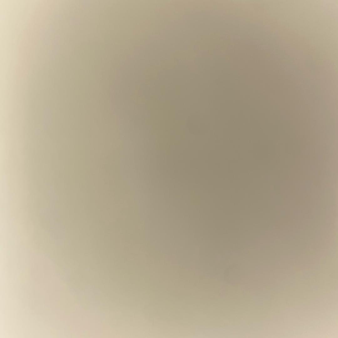 脚趾矫正源头