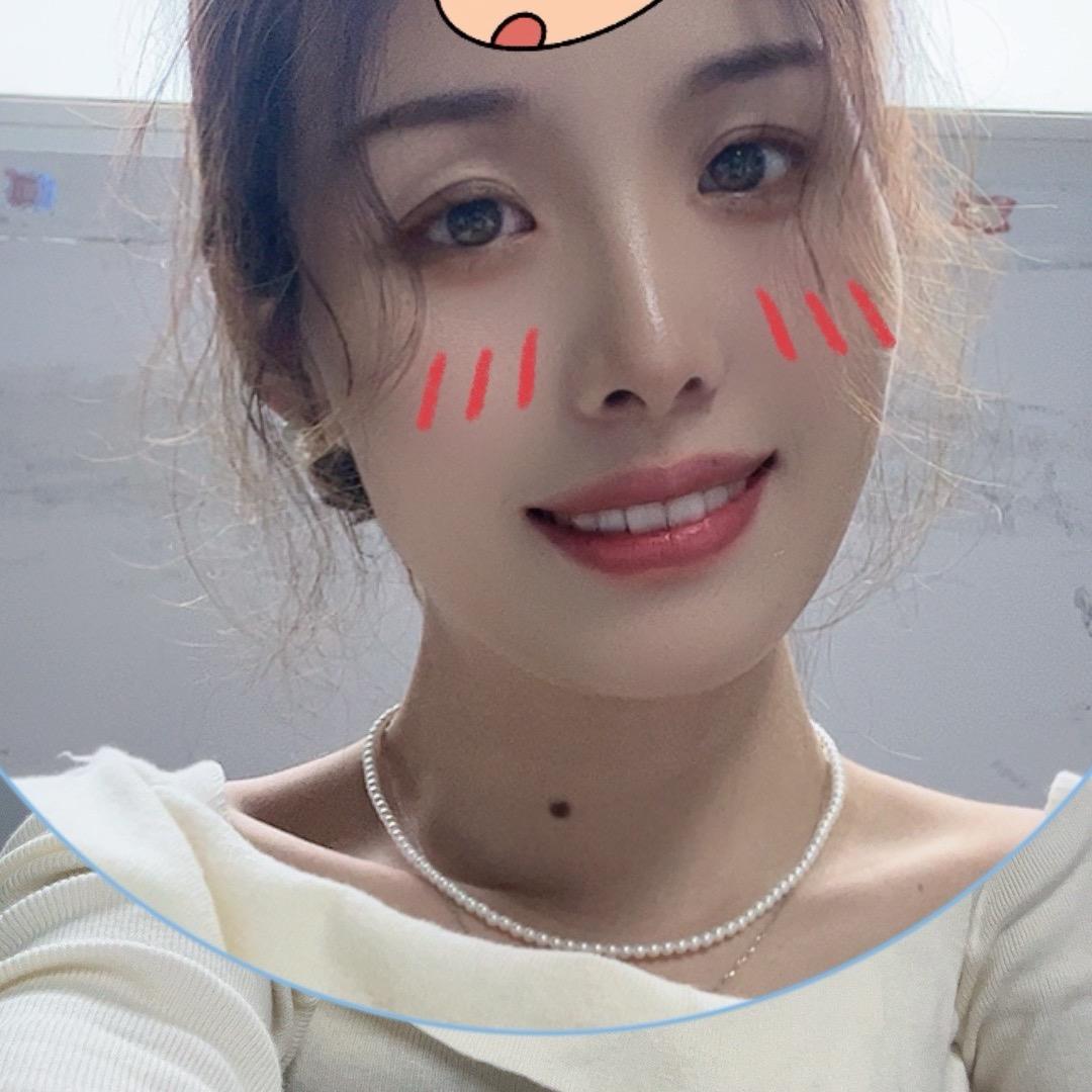 幸运星🔥