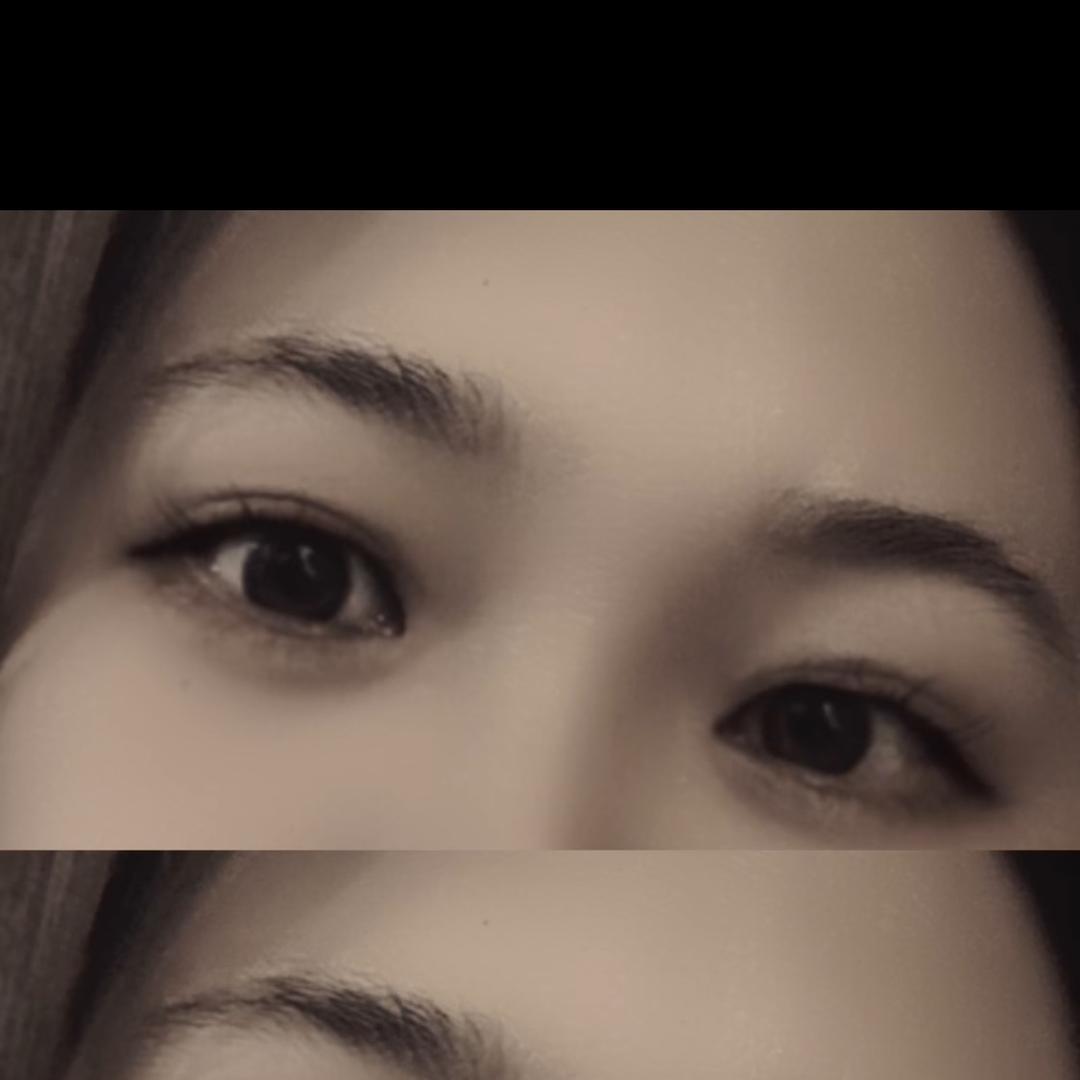 ..小林子