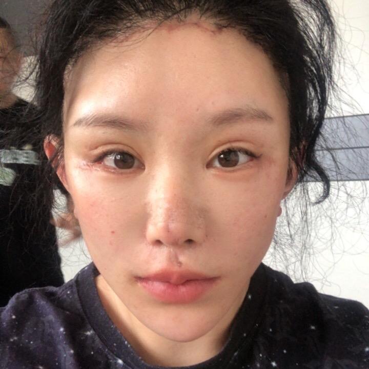 大圈圈