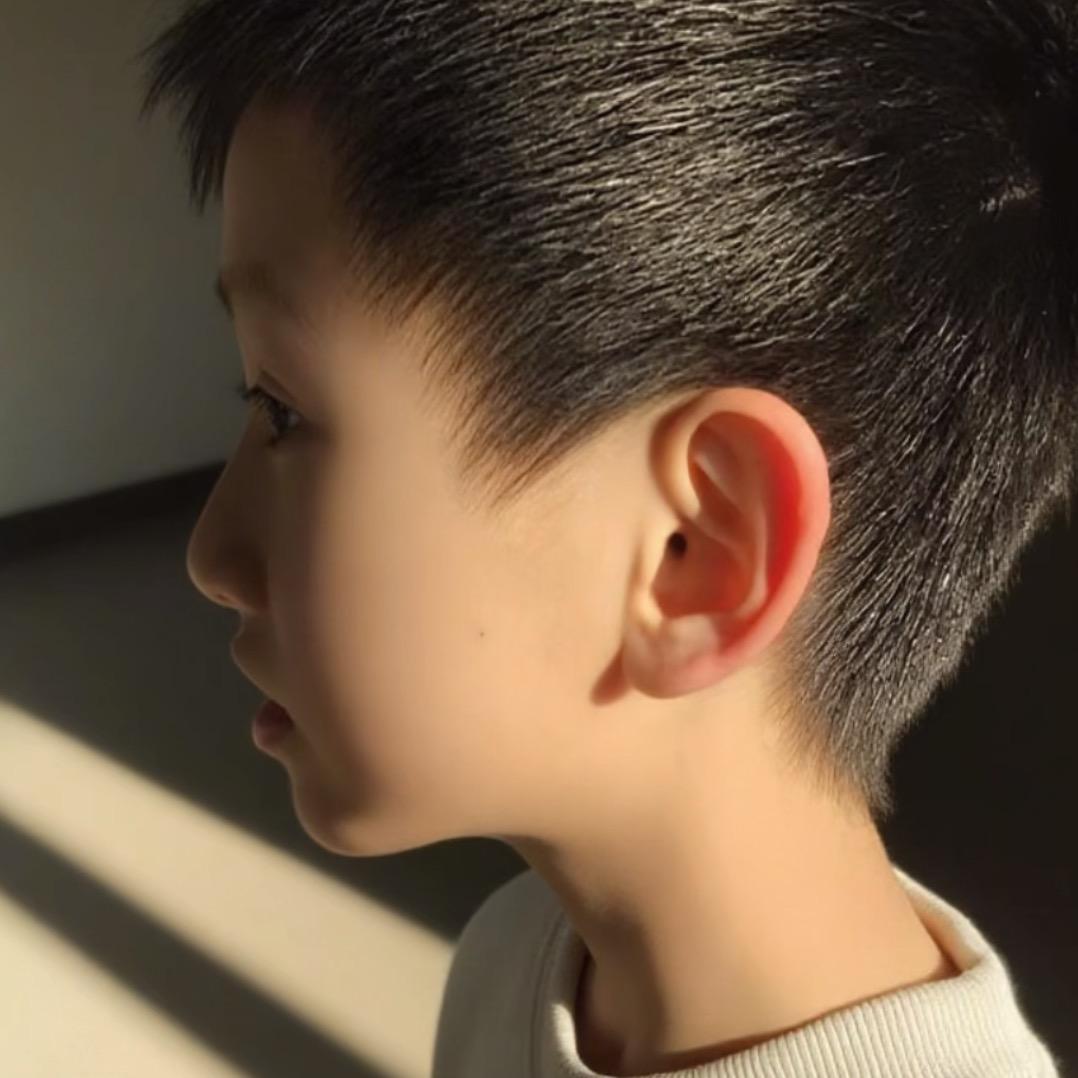 小助理