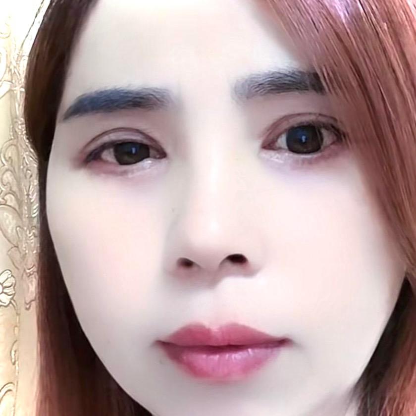 梅