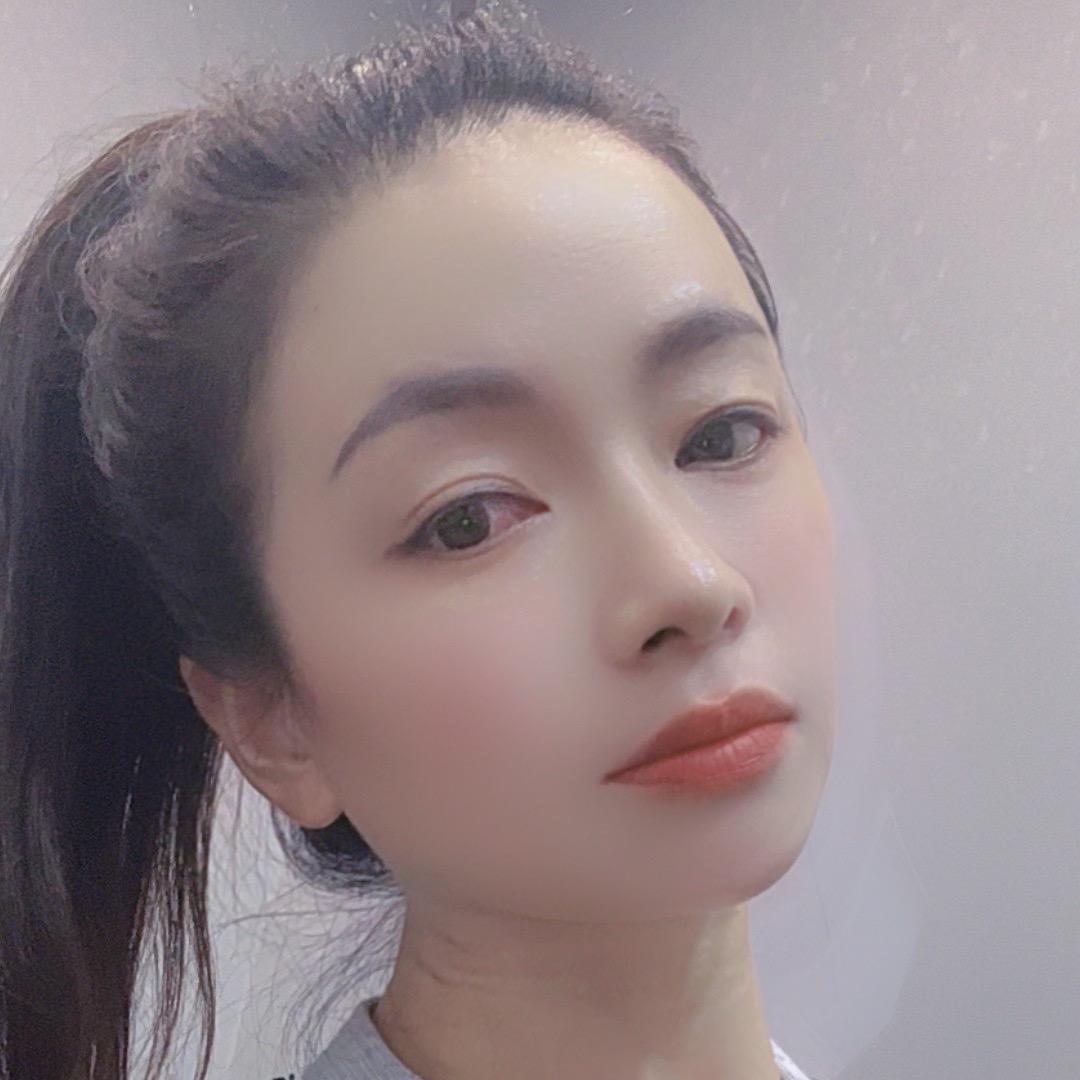糖糖