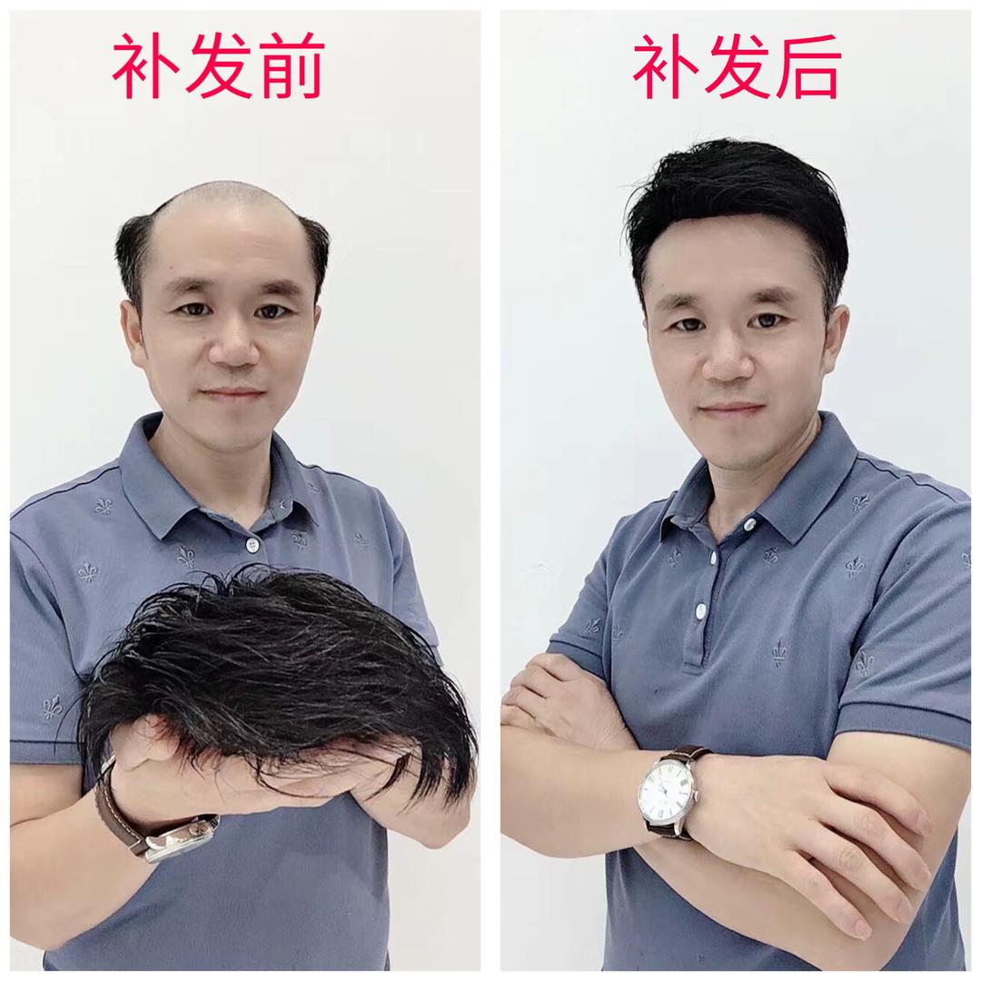 上饶蒋师傅假发定制